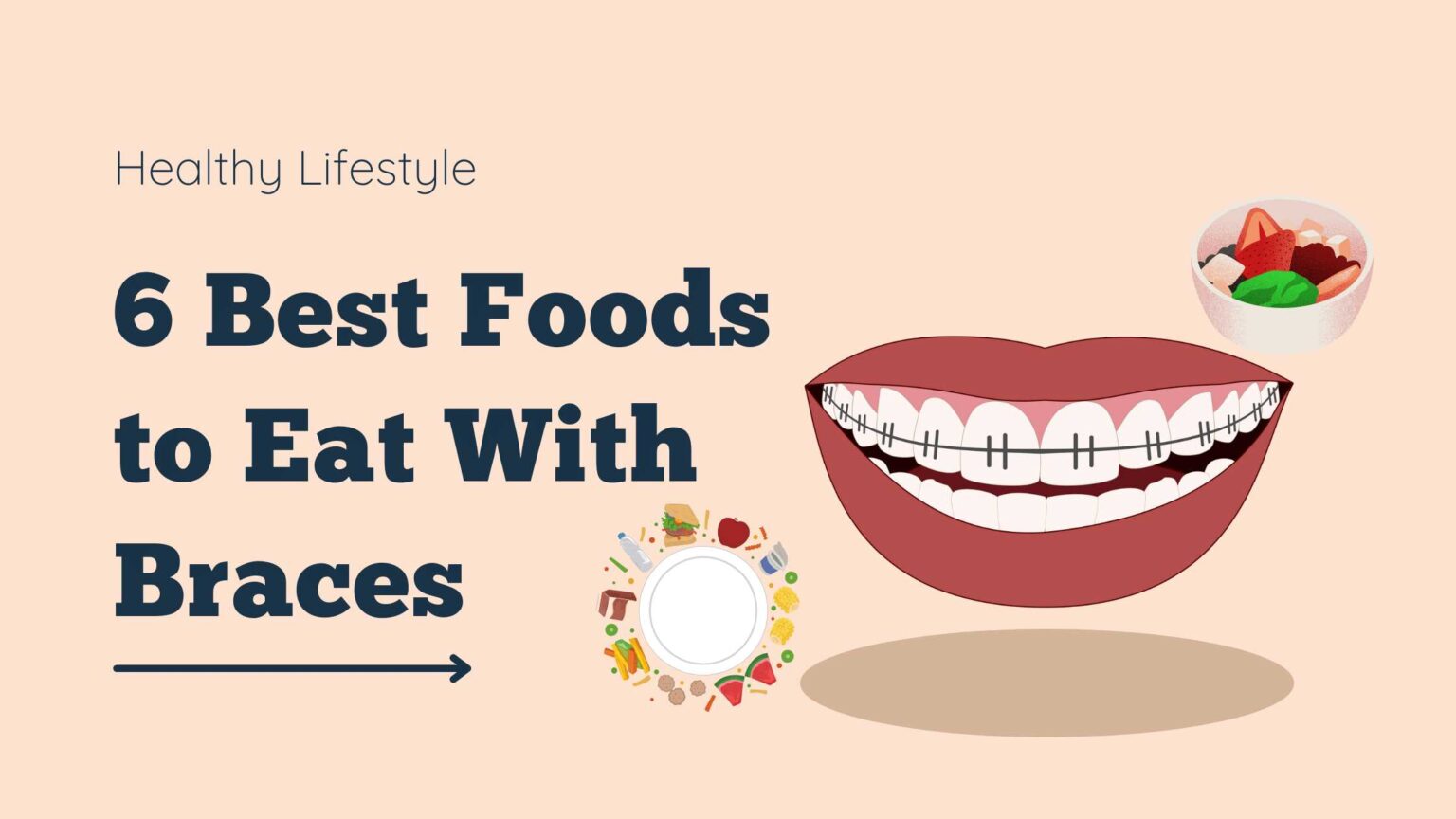 6 Best Foods To Eat With Braces » Healthy Lifestyle
