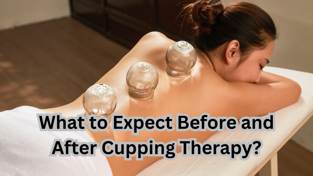 What to Expect Before and After Cupping Therapy? 2 What to expect before and after cupping therapy?