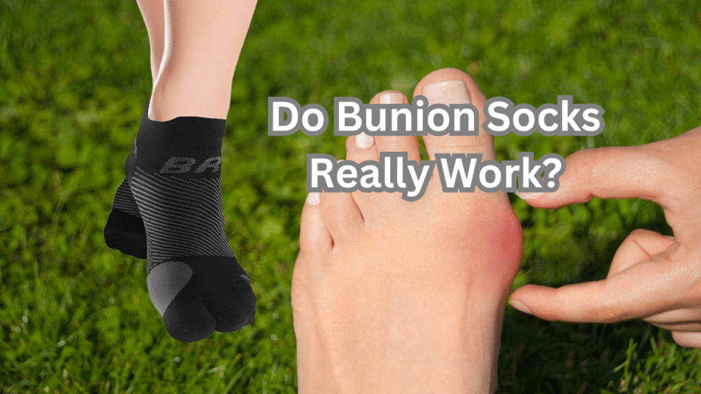 Do Bunion Socks Really Work? 2 Do Bunion Socks Really Work?