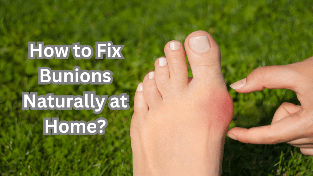 How to Fix Bunions Naturally at Home? 2 How to Fix Bunions Naturally at Home?